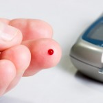 Low platelets (thrombocytopenia): causes and natural treatment