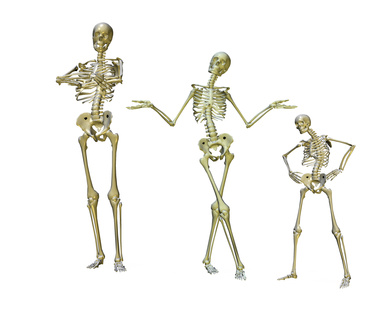 Osteoporosis: Causes, Natural Remedies and Recommended Foods