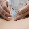 Alternative Treatments and Therapies for Multiple Sclerosis