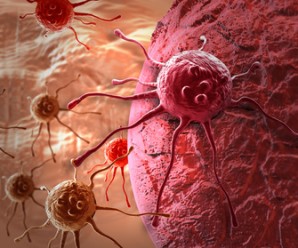 cancer cell